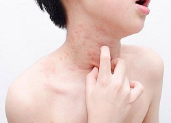 Những bộ phận trên cơ thể bị ngứa nên đi khám sớm, cẩn thận có thể là ung thư