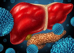 Virus viêm gan C 'sát thủ thầm lặng' gây ung thư gan