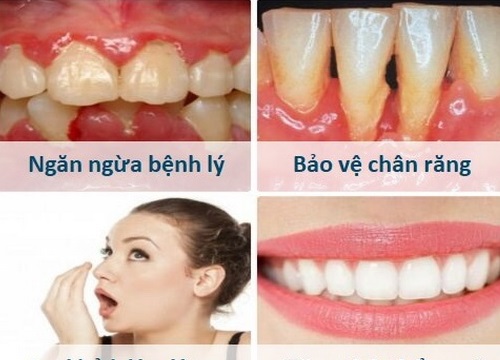 Phòng tránh cao răng và các bệnh liên quan