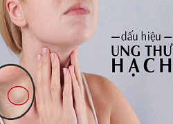 Những dấu hiệu cảnh báo ung thư hạch bạn cần chú ý