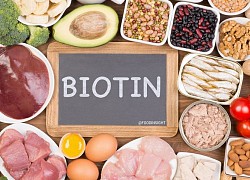 Dùng biotin liều cao khó chẩn đoán chính xác cơn đau tim