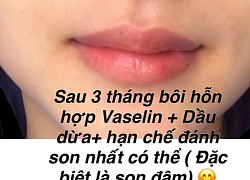 Tip trị thâm môi rẻ vô địch: Chỉ cần Vaseline và dầu dừa mà môi hồng hào, không makeup vẫn xinh tươi