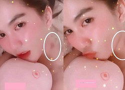 Cổ Châu Bùi xuất hiện vết lạ, sợ dân mạng nghĩ là hickey giống Ngọc Trinh hay sao mà vội thanh minh thế này