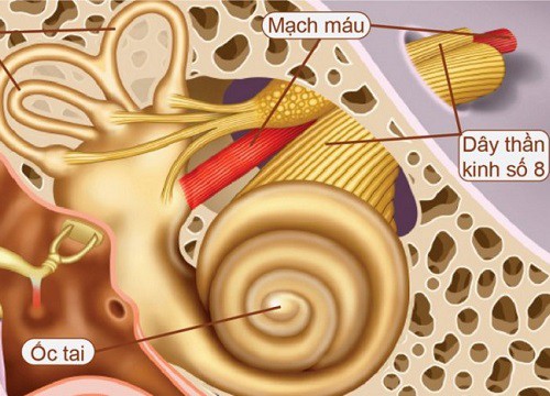 Chóng mặt, nghe kém, phát hiện u trong não