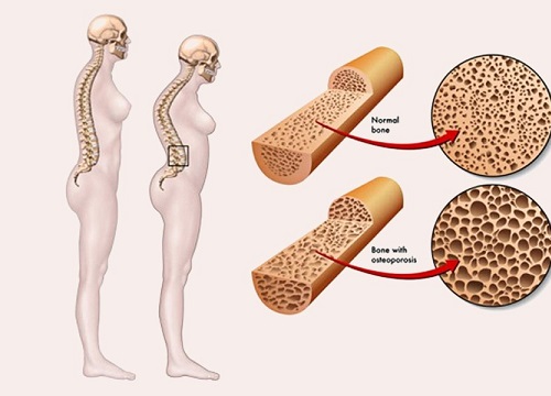 Cơ thể cần bao nhiêu magie mỗi ngày?