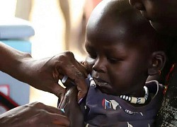 UNICEF, WHO kêu gọi tiêm chủng sởi, bại liệt