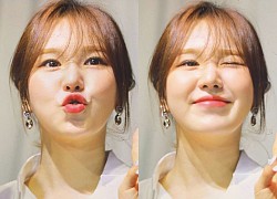 Wendy (Red Velvet) lần đầu lộ diện trong đám cưới bạn thân sau tai nạn chấn động, nhan sắc thăng hạng gây bất ngờ