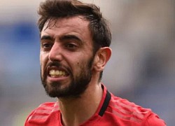 Bruno Fernandes nổi giận với sao trẻ MU