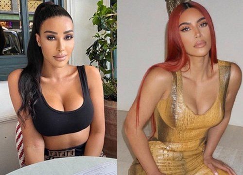 Chi 1,3 triệu USD để giống Kim Kardashian