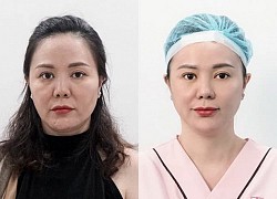 Phái đẹp Việt phát sốt với công nghệ chỉ Be-Young chuẩn y khoa hiện đại Hàn Quốc