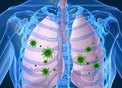 Nguyên nhân gây đợt cấp phổi tắc nghẽn mãn tính (COPD)