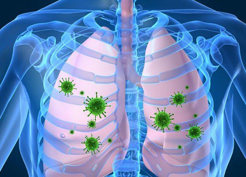 Nguyên nhân gây đợt cấp phổi tắc nghẽn mãn tính (COPD)