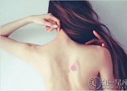 Sở hữu 4 vết bớt này, bạn có số mệnh Thiên Kim giàu sang phúc đức