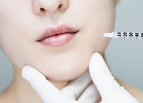 Tiêm botox gọn hàm để sở hữu gương mặt thon gọn: Chuyên gia chia sẻ những điều cần nắm rõ