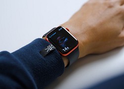 Apple muốn lắp pin vào dây đeo của Apple Watch