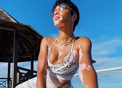 Winnie Harlow quyến rũ hút hồn giữa biển tuyệt đẹp ở Jamaica