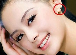 5 nốt ruồi quý hơn vàng mười, ai sở hữu thì giàu sang, phúc lộc, vận thế ngày càng đi lên