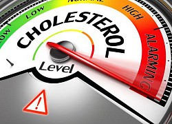 Mức cholesterol nên là bao nhiêu với mỗi độ tuổi?