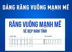 4 dáng răng sứ được yêu thích hiện nay