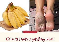 Lộ bàn chân sần sùi khi mang giày hở gót, áp dụng ngay cách trị nứt nẻ gót chân này