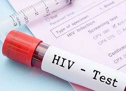 Vì sao độ tuổi được xét nghiệm HIV tự nguyện giảm xuống đủ 15 tuổi?