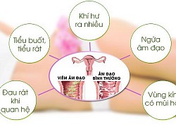 Điểm mặt "thủ phạm" có thể gây vô sinh, hiếm muộn