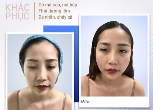 'Cải lão hoàn đồng' trẻ ra 10 tuổi nhờ phương pháp làm đẹp đa công nghệ hot nhất