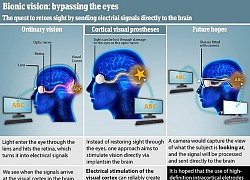 Cấy ghép thị giác nhân tạo cho người khiếm thị