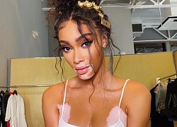 Người mẫu nội y Winnie Harlow tăng 11 kg