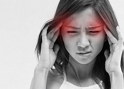 Đau nửa đầu migraine có thế gây đột quỵ ở người trẻ