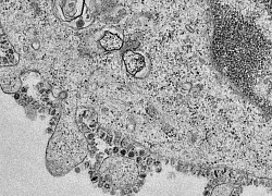 Công bố hình ảnh đầu tiên về sự sinh sản đáng sợ của virus corona chủng mới