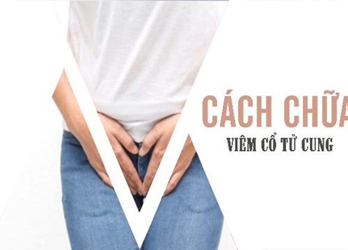 Viêm cổ tử cung có chữa được không? Đâu là phương pháp an toàn và hiệu quả?