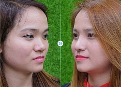 Việt Kiều ngạc nhiên khi bị thẩm mỹ viện Newface... từ chối nâng mũi