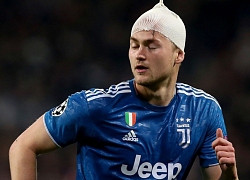 De Ligt đổ máu trong thất bại của Juventus