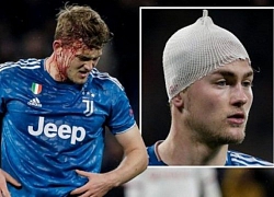 &#8220;Sự vắng mặt của De Ligt đã giúp Lyon đánh bại Juventus&#8221;