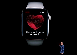 Apple Watch không thể phát hiện AFib ở nhịp tim trên 120bpm