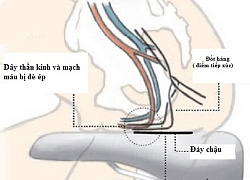 Các nguyên nhân không ngờ gây rối loạn cương dương