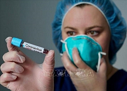 Các trường hợp muốn xét nghiệm virus SARS-CoV-2 tại Mỹ phải có chỉ định của bác sĩ