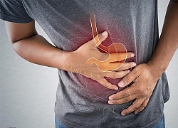 Bác sĩ ơi: Nguyên nhân và triệu chứng viêm dạ dày