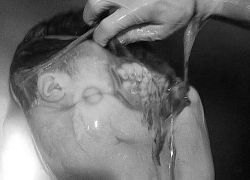 Mặc bác sĩ và ê-kíp mổ muốn làm gì thì làm, em bé vẫn say sưa ngủ ngon lành
