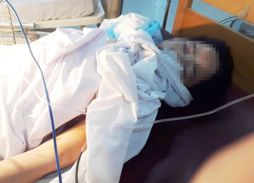Thông tin mới vụ người phụ nữ bị chồng cũ truy sát đến nguy kịch