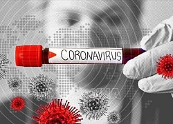 Mỹ cấp phép cho bộ xét nghiệm virus SARS-CoV-2 trong vòng 3,5 giờ