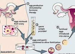 Nguy cơ thường gặp khi thụ tinh trong ống nghiệm
