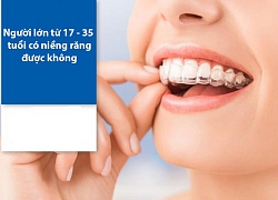 Niềng răng là gì? Niềng răng có đau không và những lưu ý bạn nên biết