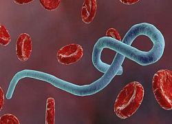 Sử dụng virus Ebola để... điều trị ung thư não