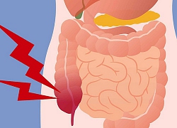 4 lý do chẳng ai ngờ đến nhưng lại là nguyên nhân khiến vùng kín và hậu môn của con gái ngứa ngáy