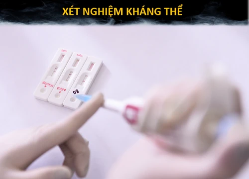 Các phương pháp xét nghiệm Covid-19 hiện nay khác nhau như thế nào?