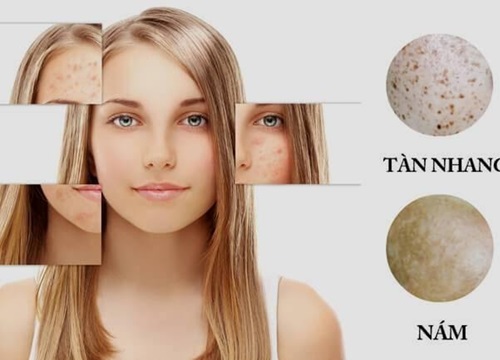 Collagen thuỷ phân Xu hướng làm đẹp mới