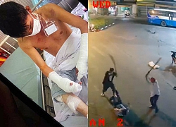 Bắt 2 kẻ chém người đàn ông dã man trước cây xăng