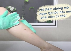 Tips dành cho chị em có đôi chân hoa gấm 'tím lịm tìm sim': Thói quen tắm hàng ngày có thể trị sạch vết thâm cứng đầu